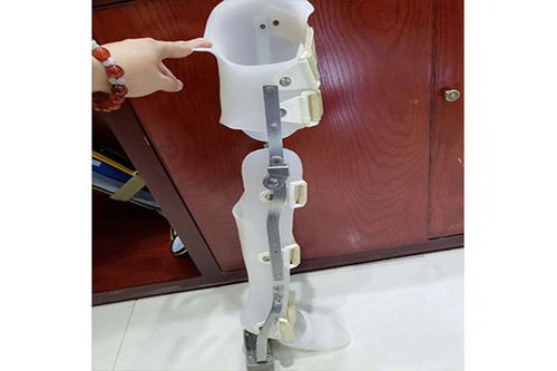 假肢與矯形器的使用周期與更換指南 科學(xué)維護(hù)，保障生活品質(zhì)